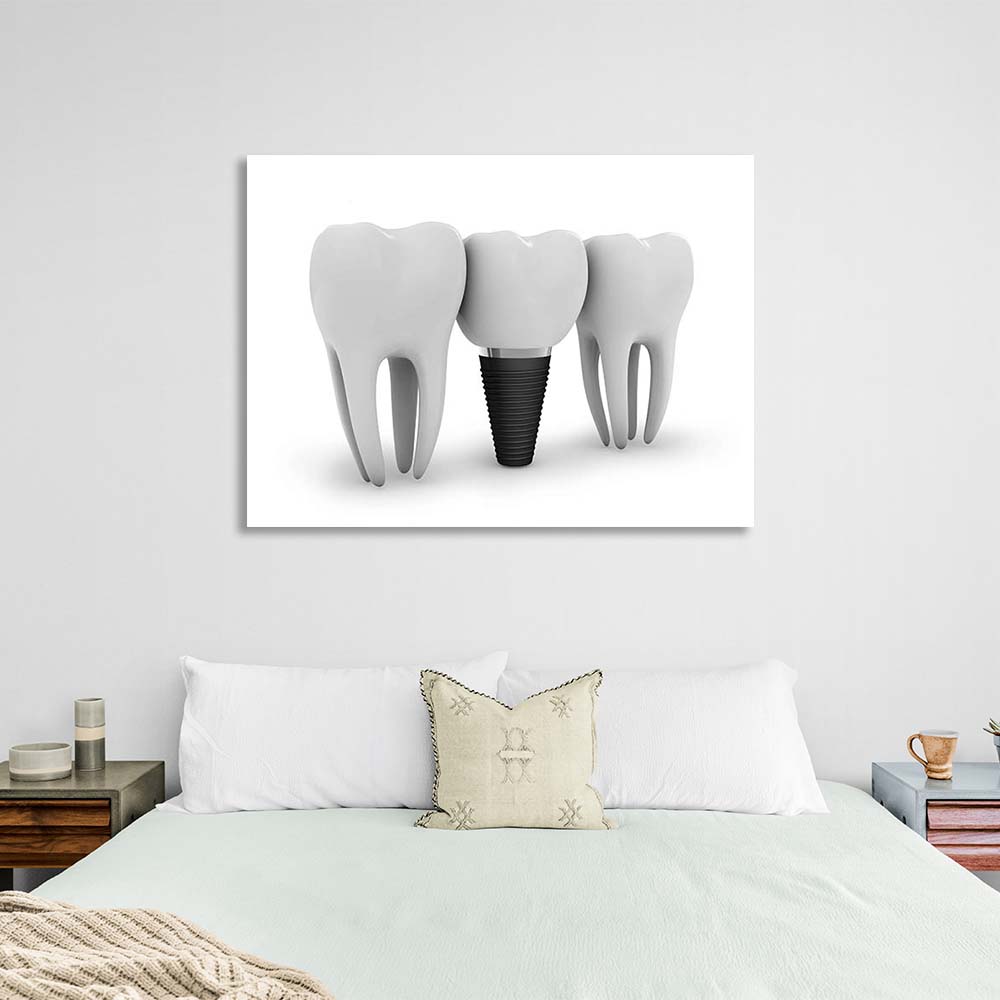 Three teeth on a white background Canvas Wall Art Print