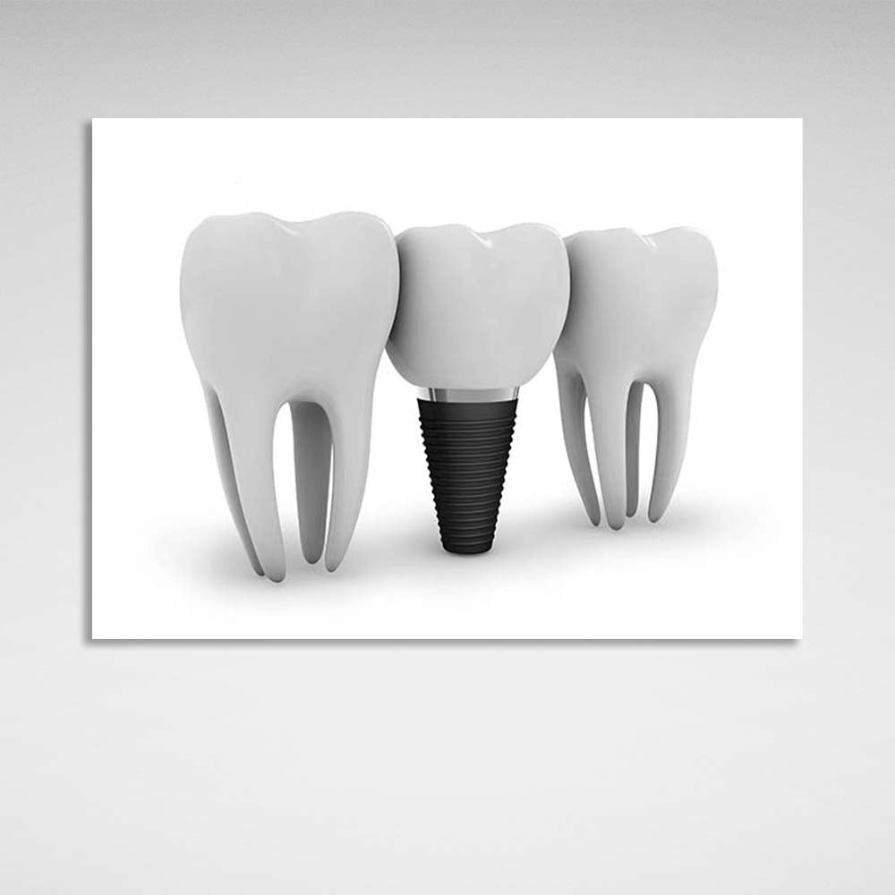 Three teeth on a white background Canvas Wall Art Print