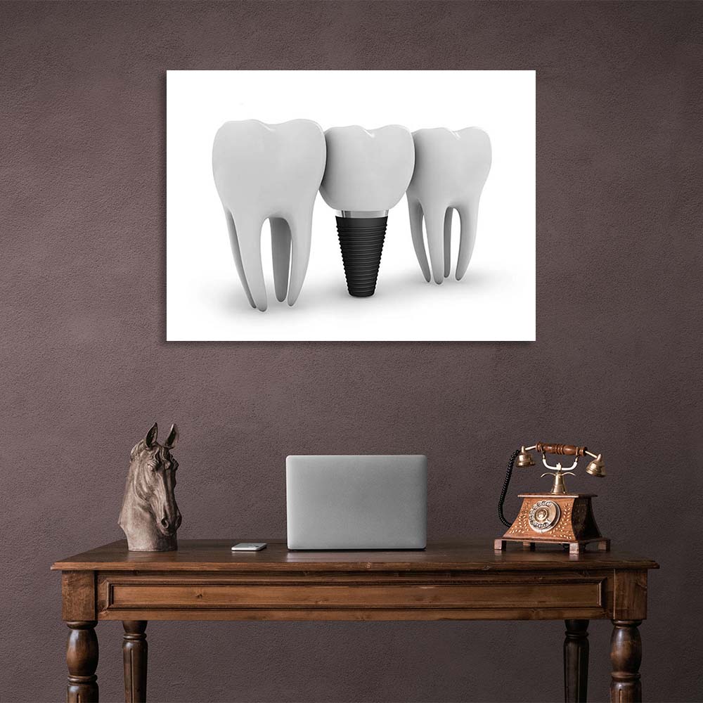 Three teeth on a white background Canvas Wall Art Print